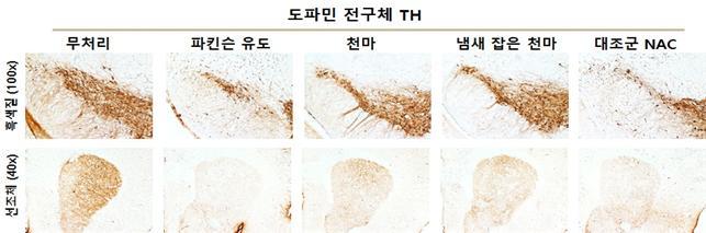 <strong>파라-크레졸 제거 천마 추출물을 투여한 파킨슨병 신경독성모델 생쥐의 뇌 선조체와 흑색질에서 도파민 전구체 TH 발현 조직 사진</strong>